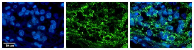 DLD Antibody in Immunohistochemistry (Paraffin) (IHC (P))