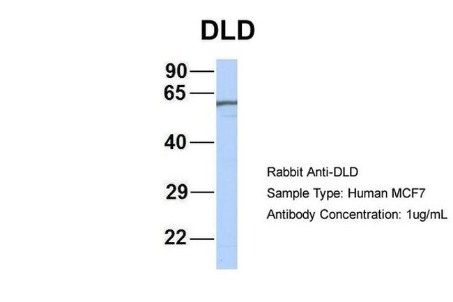 DLD Antibody in Western Blot (WB)