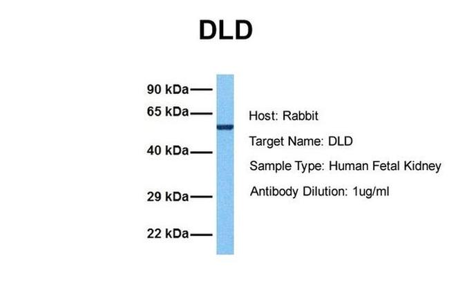 DLD Antibody in Western Blot (WB)