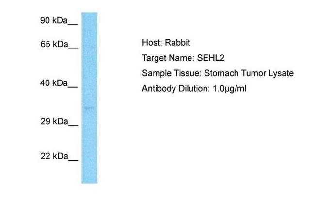 SERHL2 Antibody in Western Blot (WB)