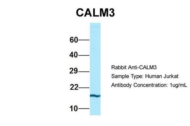 Calmodulin 3 Antibody in Western Blot (WB)