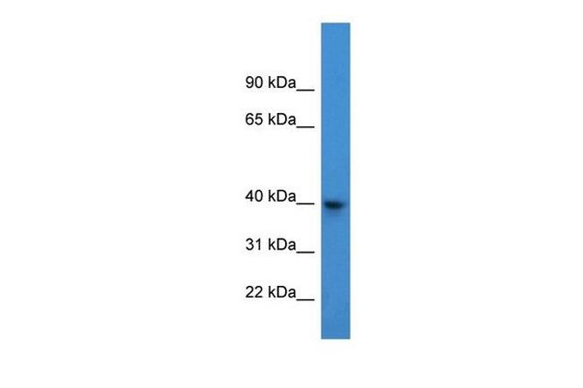 ACTRT3 Antibody in Western Blot (WB)