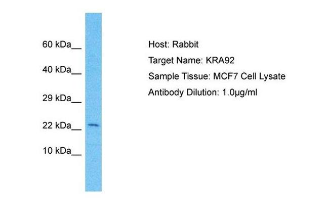 KRTAP9-2 Antibody in Western Blot (WB)