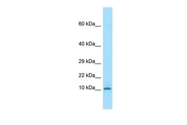 KRTAP3-3 Antibody in Western Blot (WB)