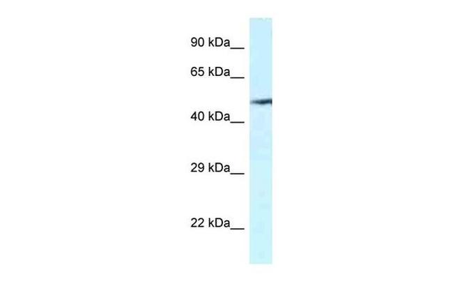 VNN2 Antibody in Western Blot (WB)