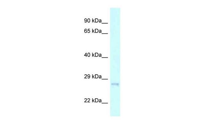 CHMP2A Antibody in Western Blot (WB)