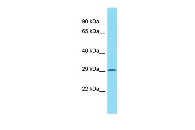 ATPAF2 Antibody in Western Blot (WB)