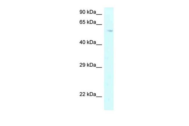 P4HA2 Antibody in Western Blot (WB)