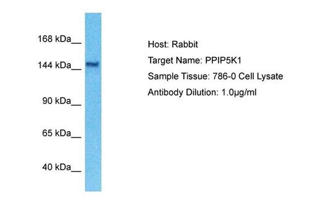 IP6 Kinase Antibody in Western Blot (WB)