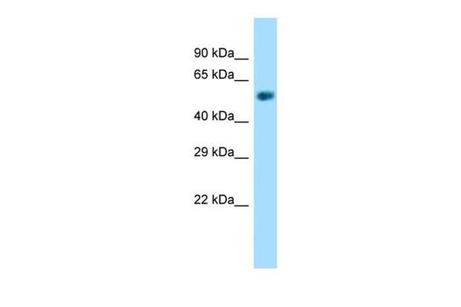 NAPRT1 Antibody in Western Blot (WB)