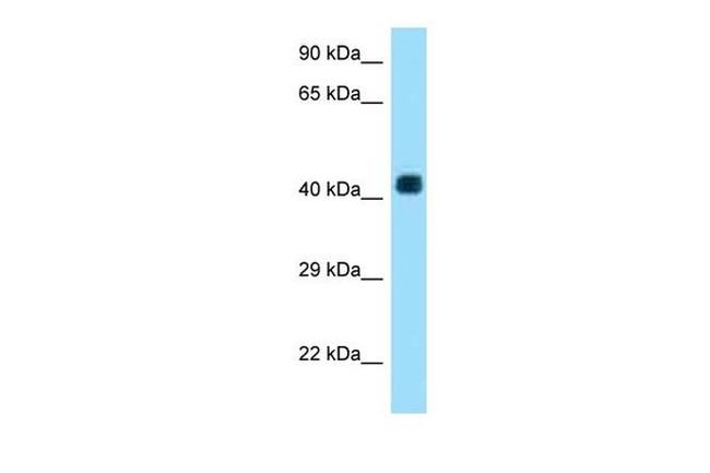 AADACL3 Antibody in Western Blot (WB)