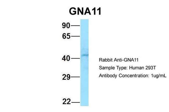 GNA11 Antibody in Western Blot (WB)