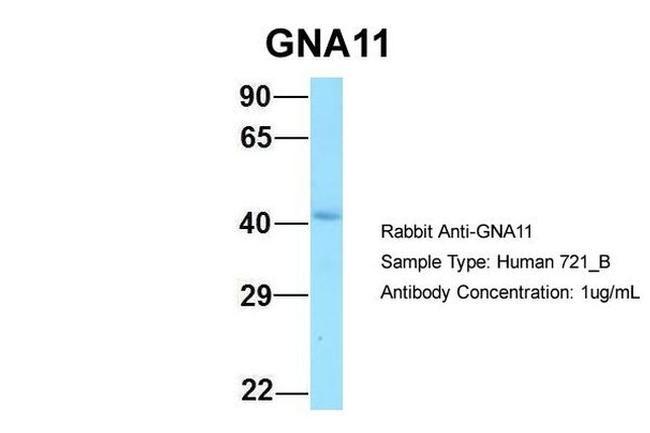 GNA11 Antibody in Western Blot (WB)