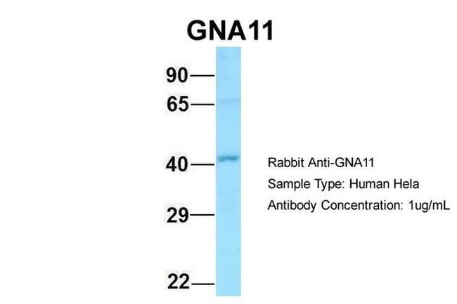 GNA11 Antibody in Western Blot (WB)