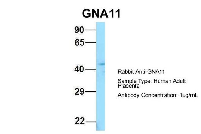 GNA11 Antibody in Western Blot (WB)