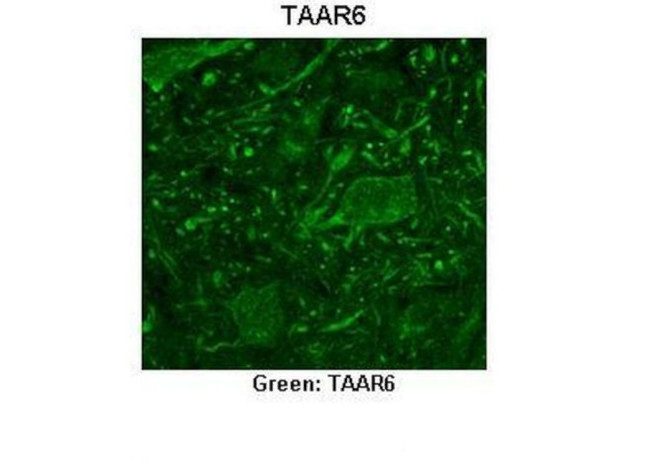 TAAR6 Antibody in Immunohistochemistry (IHC)