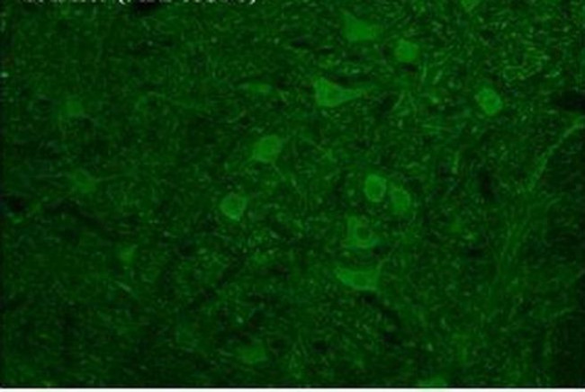 TAAR6 Antibody in Immunohistochemistry (IHC)