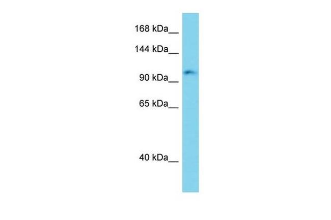 Erc2 Antibody in Western Blot (WB)