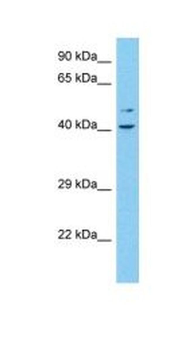 FAM148B Antibody in Western Blot (WB)