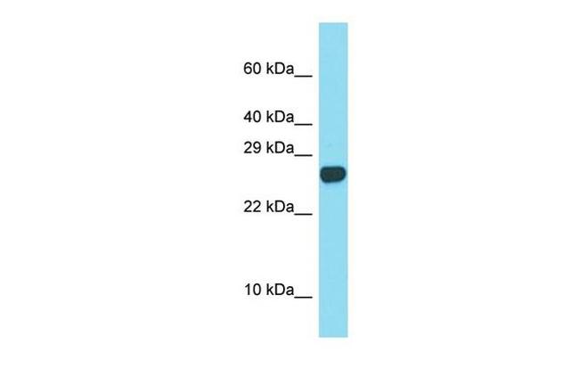 SPACA3 Antibody in Western Blot (WB)