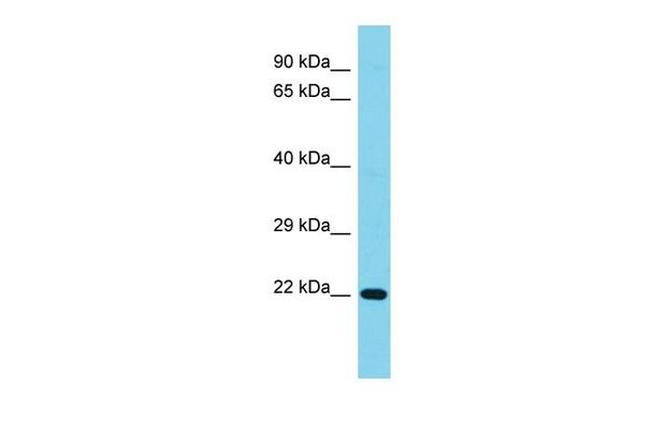 C1orf158 Antibody in Western Blot (WB)