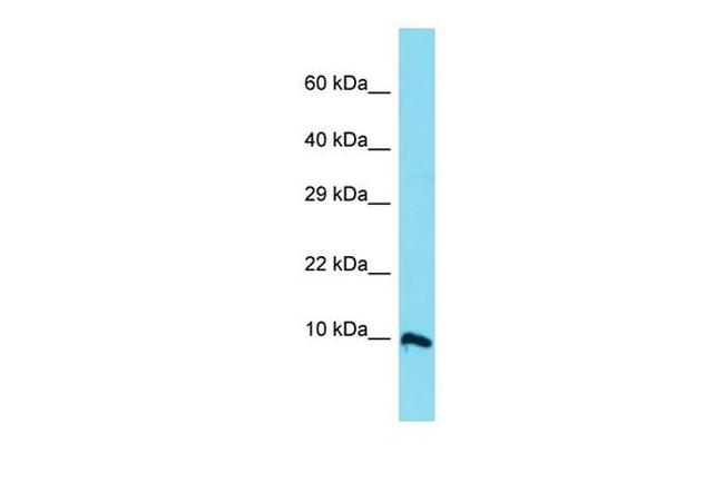 C11orf94 Antibody in Western Blot (WB)