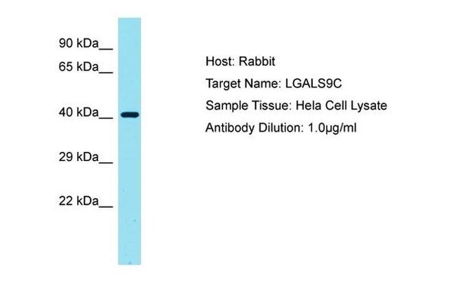 LGALS9C Antibody in Western Blot (WB)