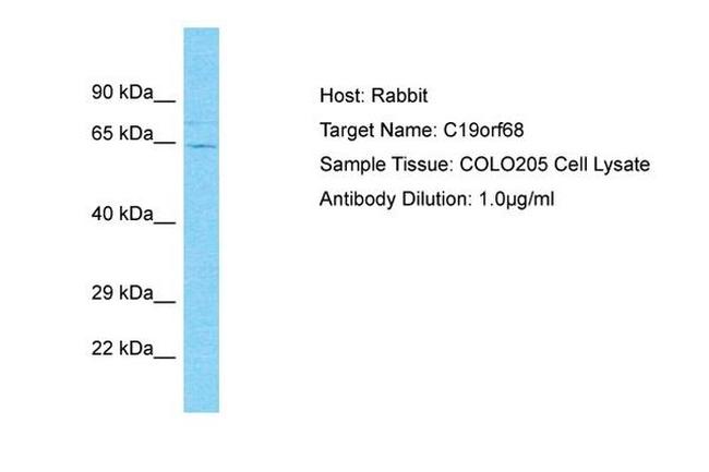 C19orf68 Antibody in Western Blot (WB)