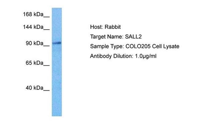 SALL2 Antibody in Western Blot (WB)