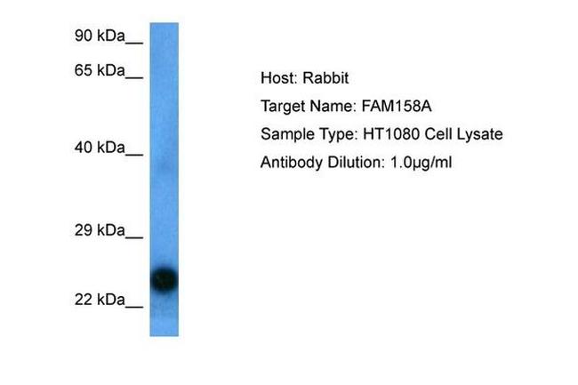 EMC9 Antibody in Western Blot (WB)