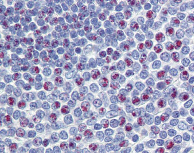 FOXM1 Antibody in Immunohistochemistry (IHC)