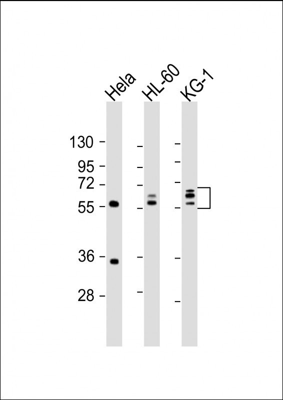 FGL2 Antibody in Western Blot (WB)