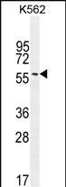 EIF2B4 Antibody in Western Blot (WB)