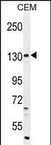 DUOX2 Antibody in Western Blot (WB)