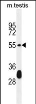 Krt33a Antibody in Western Blot (WB)