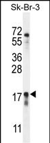 C1orf115 Antibody in Western Blot (WB)