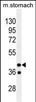 GIN1 Antibody in Western Blot (WB)