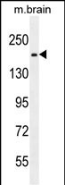 FIP200 Antibody in Western Blot (WB)