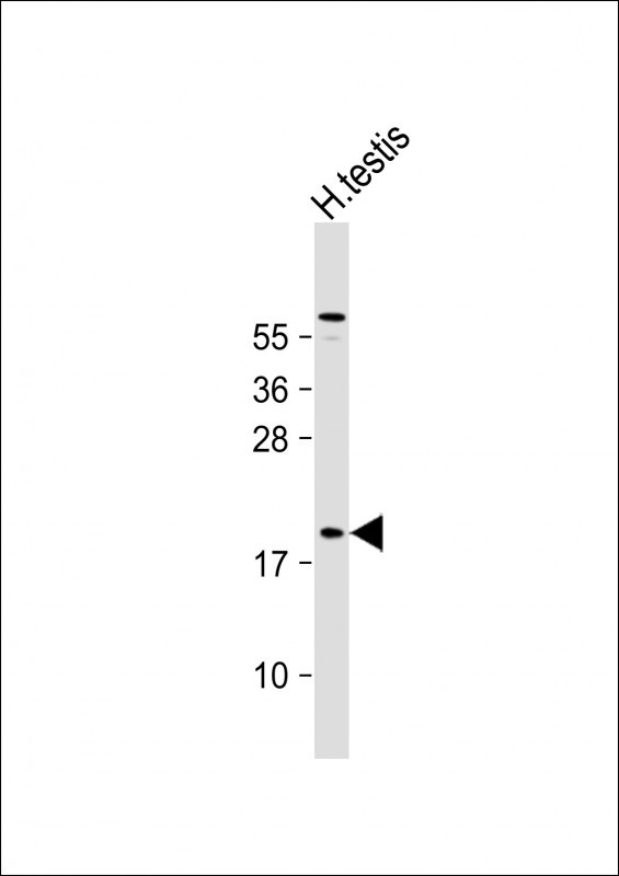 CT45A Antibody in Western Blot (WB)