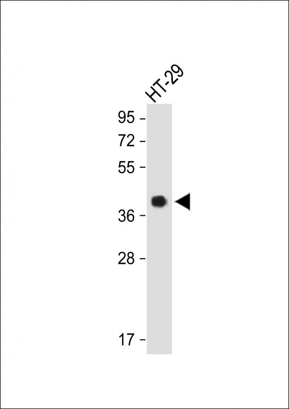 OR2AT4 Antibody in Western Blot (WB)