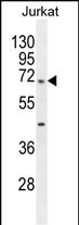 TBC1D3H Antibody in Western Blot (WB)