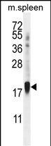 ZNF593 Antibody in Western Blot (WB)