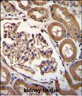 CD249 Antibody in Immunohistochemistry (Paraffin) (IHC (P))