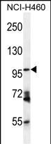 CD249 Antibody in Western Blot (WB)