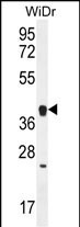 OR2T8 Antibody in Western Blot (WB)