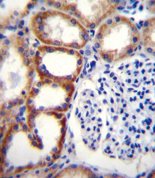 SDHD Antibody in Immunohistochemistry (Paraffin) (IHC (P))