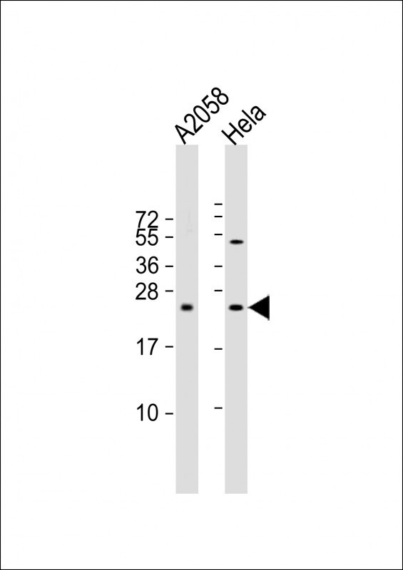 SDHD Antibody in Western Blot (WB)