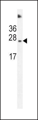 SDHD Antibody in Western Blot (WB)