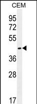 OR8H2/OR8H3 Antibody in Western Blot (WB)