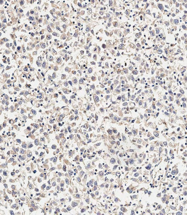 ASM Antibody in Immunohistochemistry (Paraffin) (IHC (P))